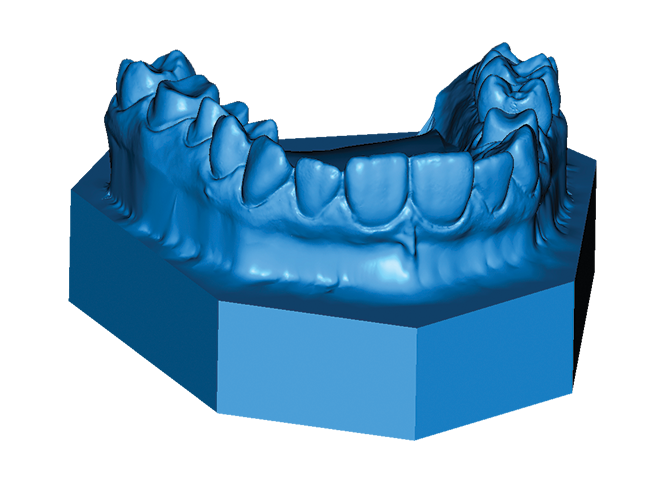skan 3d stomatologia